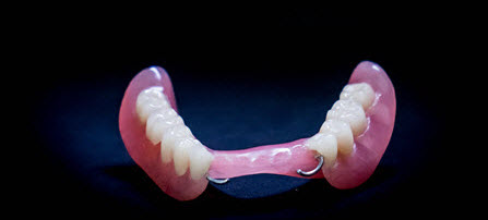 bugelniy-protez-v-orshe